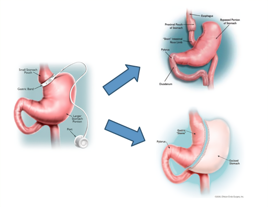 revision-and-conversion-procedures